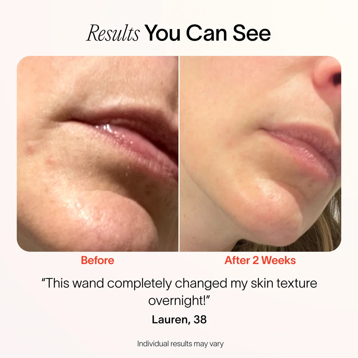 LiftSkin – The Life Shop