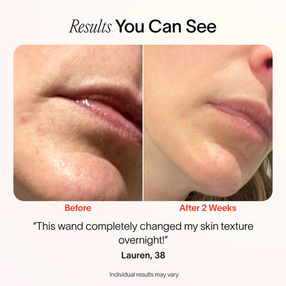 LiftSkin – The Life Shop